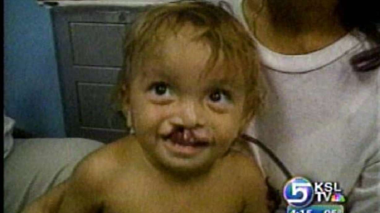 Volunteers Gather for Operation Smile