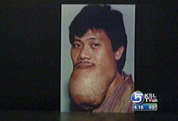 Volunteers Gather for Operation Smile