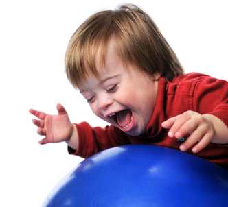 Study shows prevalence of Down syndrome in Utah