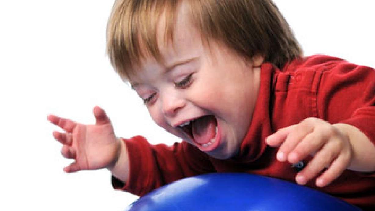 Study shows prevalence of Down syndrome in Utah