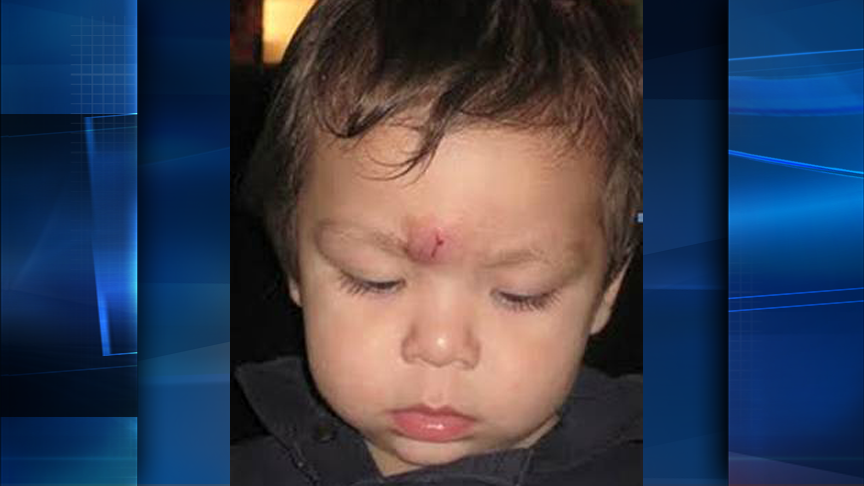 Safety experts say kids can end up with "goose eggs" or broken toes if proper safety precautions aren't taken with heavy Christmas stocking hangers