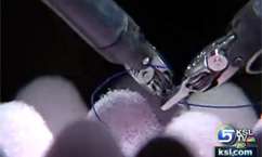 Video Games May Develop Skills for Future Surgeons