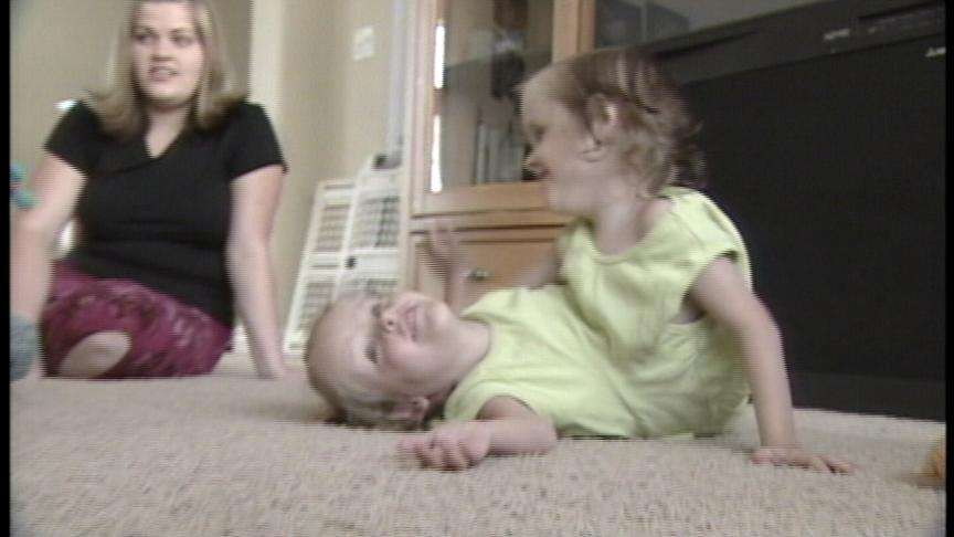 Surgeons Prepare to Separate Conjoined Twins