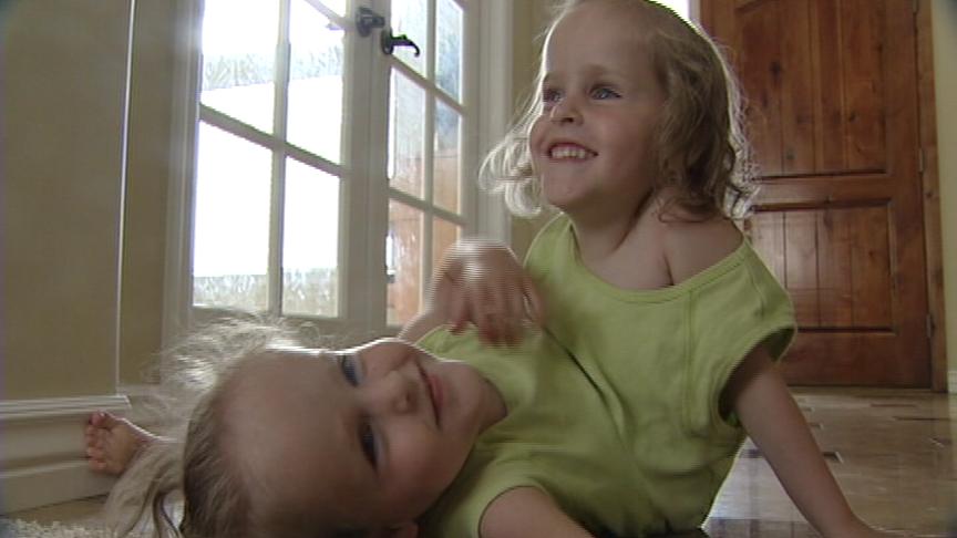 Herrin Twins Breathing On Their Own