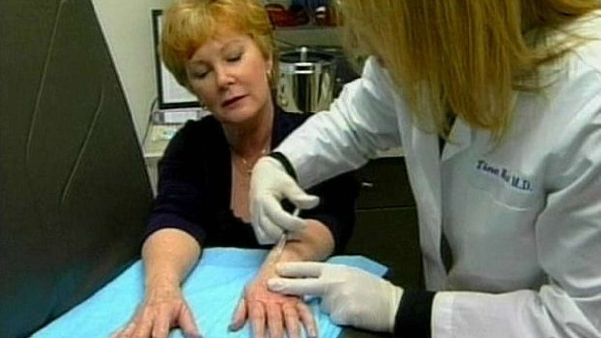 New Procedure Reduces Signs of Aging in Hands