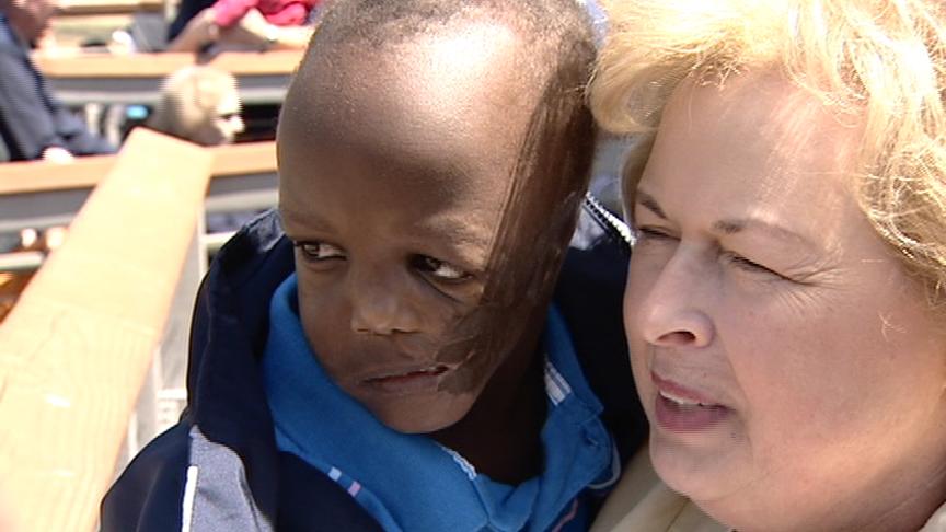 Boy Prepares for Series of Facial Surgeries