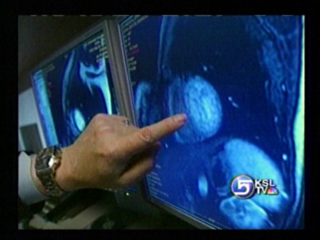 New Tool Helping Diagnose "Hidden Heart Disease."