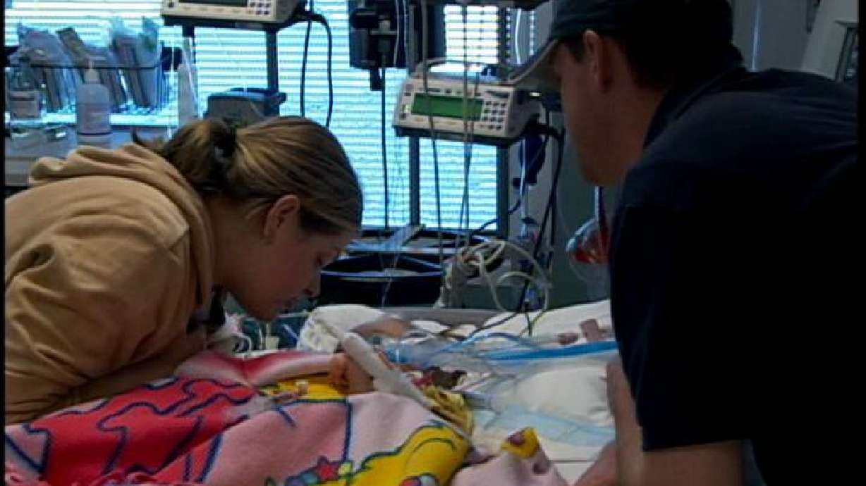 Separated Twins Continue to Do Well