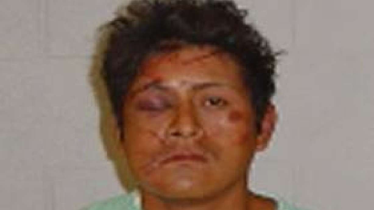 Father Beats Up Man Suspected of Molesting Daughter