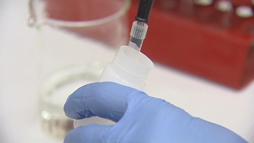 University of Utah Study May Help Alzheimer's Patients