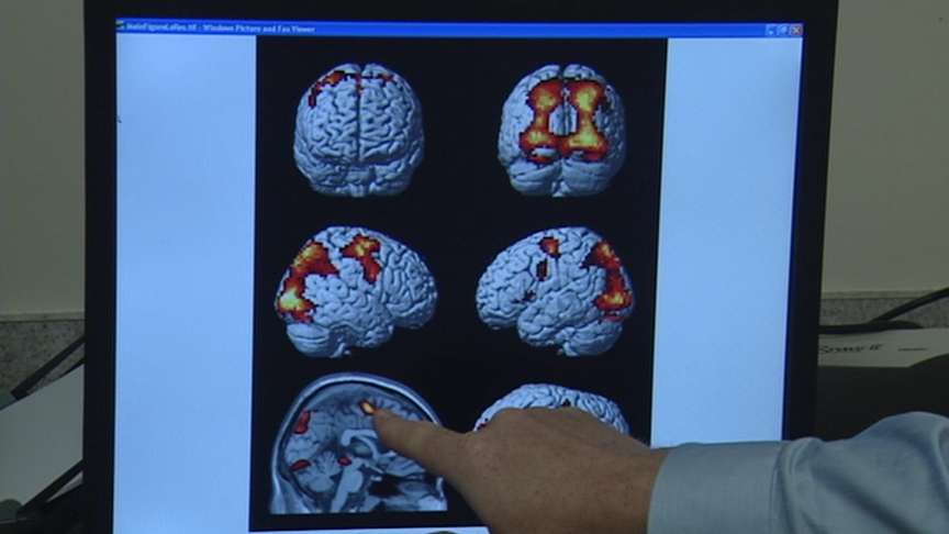 As each participant looked at the body images, the researchers were able to look at the activation happening in their brains.