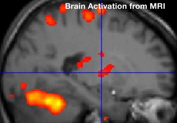 VA Researchers Develop New Study for Panic Disorder