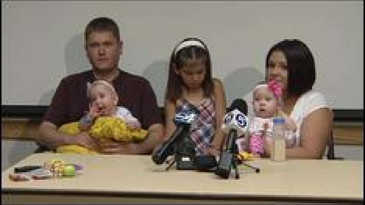 Former Conjoined Twins About to Celebrate First Birthday