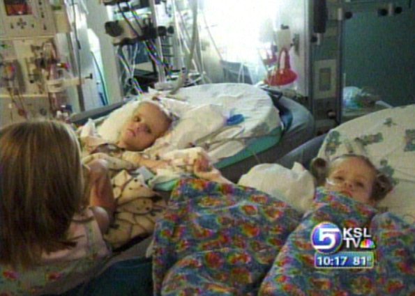 Twins Still Face Psychological Healing 