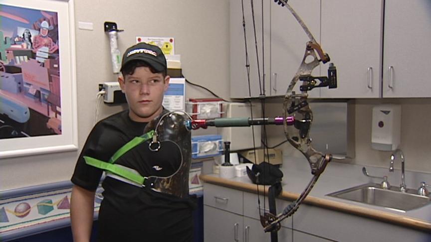 Unique Prosthesis Helps Teen Archer Hit His Mark