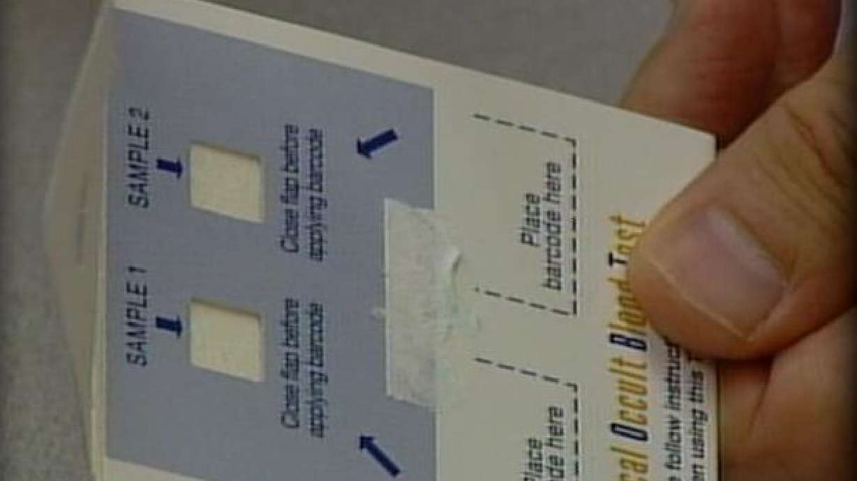 New Home Test to Screen for Colon Cancer