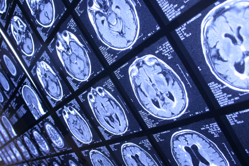 Protecting Your Memory 