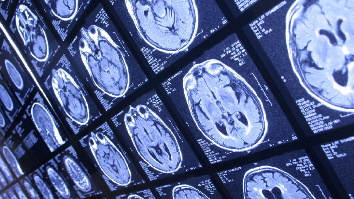 Protecting Your Memory