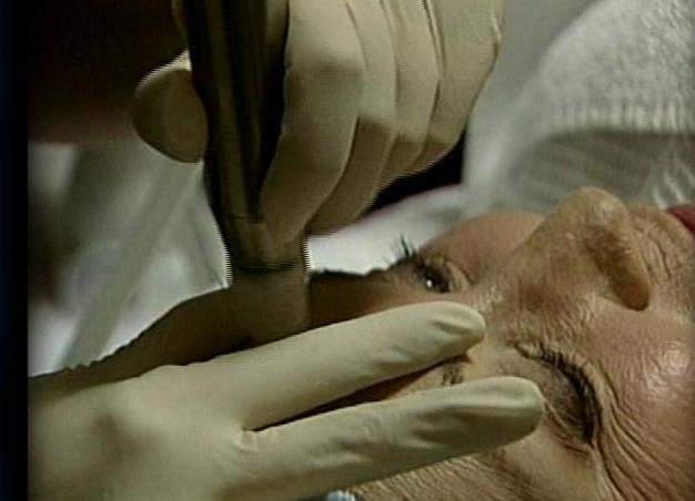 New Treatment Cuts Skin Cancer Risk