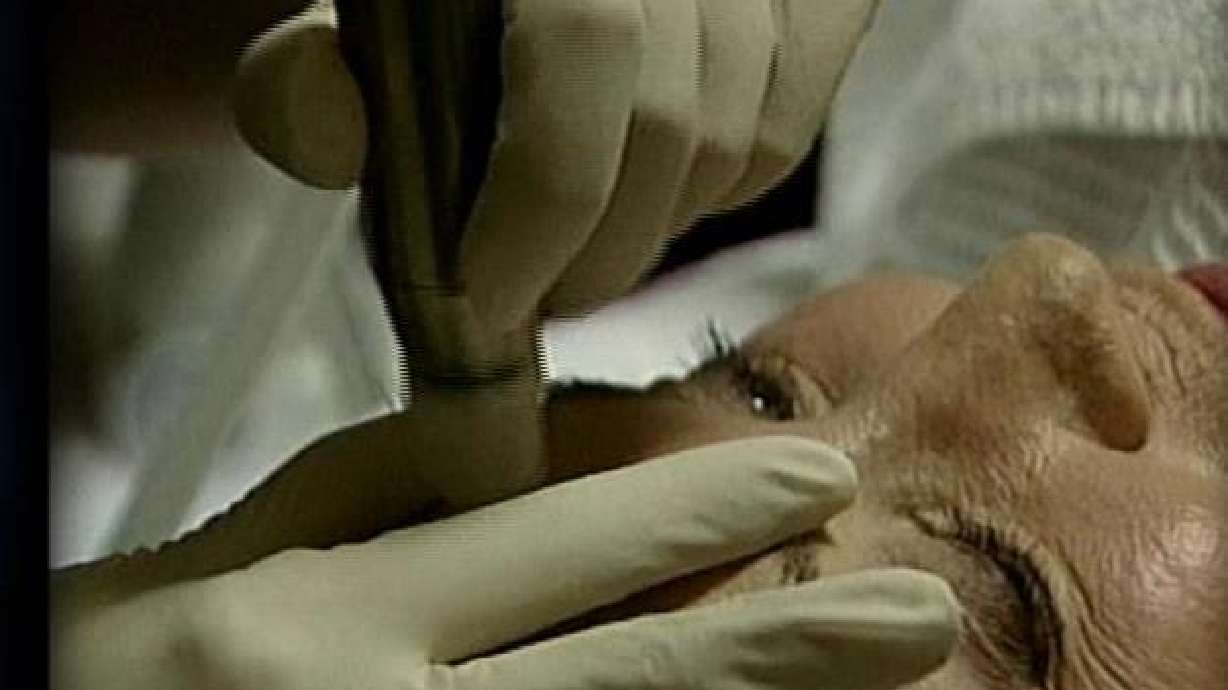 New Treatment Cuts Skin Cancer Risk