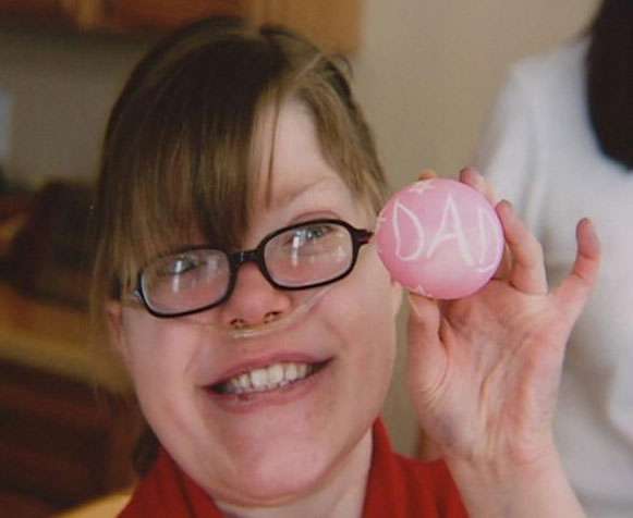 Katie Mathews died at the age of 15 as the result of a genetic disorder known as DiGeorge syndrome.