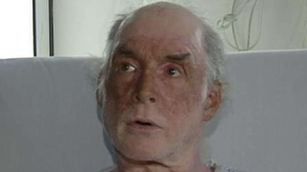 Stabbing Victim Says Suspect's Motive Was Robbery