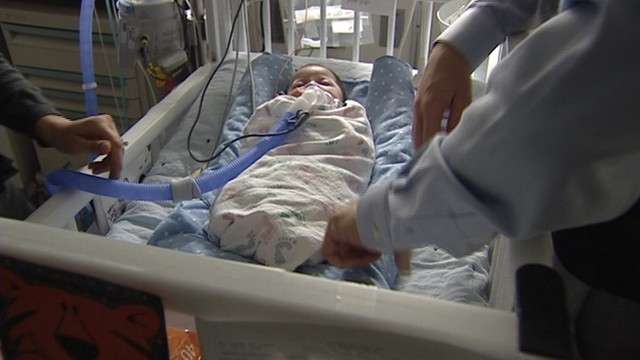 At just 13 weeks old, Paxton Norton has already undergone 18 medical procedures.