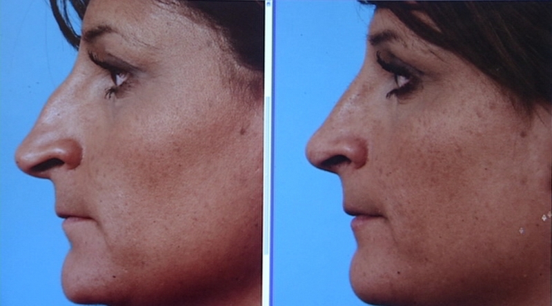 Before and after images