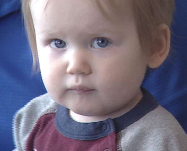 Little Skyler came to the Flakes with injuries so severe he had to be hospitalized. At 1-year-old, he\'s thriving in his adoptive family.