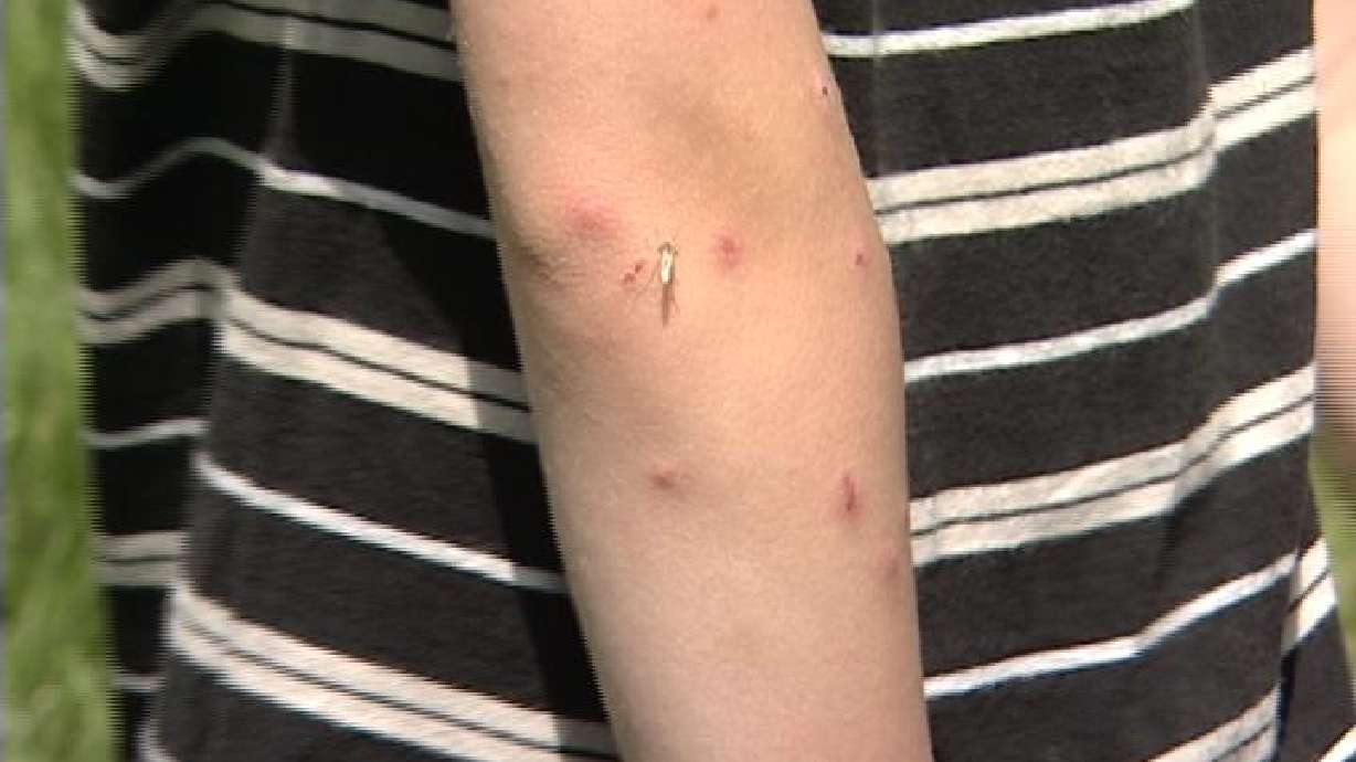 Insects no match for new 'uber' repellent