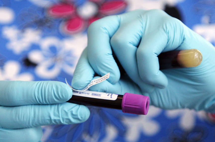 The adventure of being a guinea pig for USU science