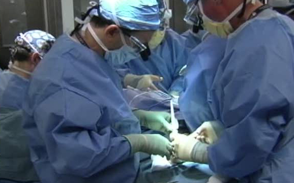 Facial transplant surgery still evolving