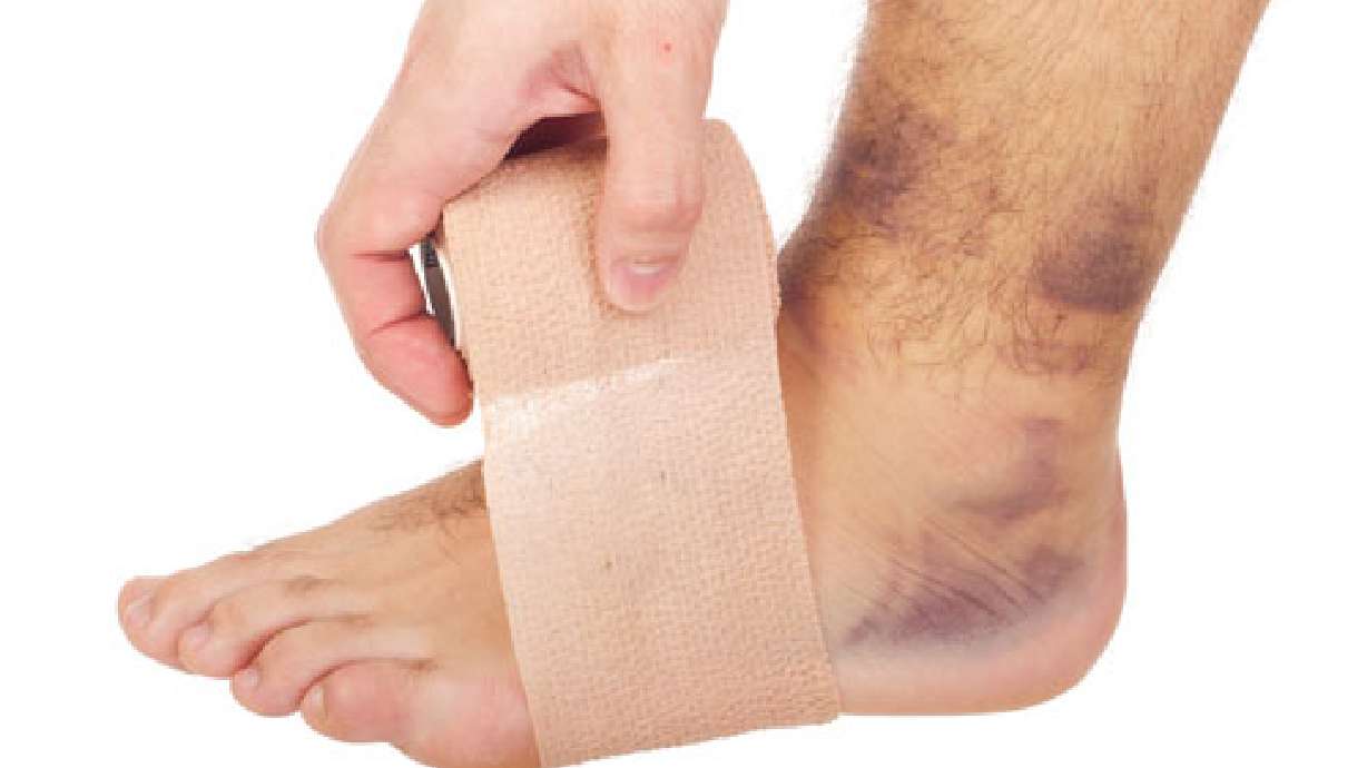 Mommy Medicine: Broken or sprained?