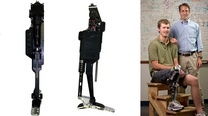 New Bionic Leg Thinks and Moves Like a Real Limb [Prosthetics]