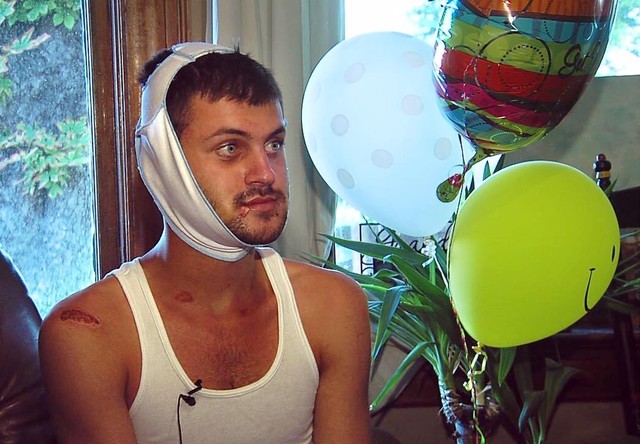 Police chief visiting clubs following attack of gay man