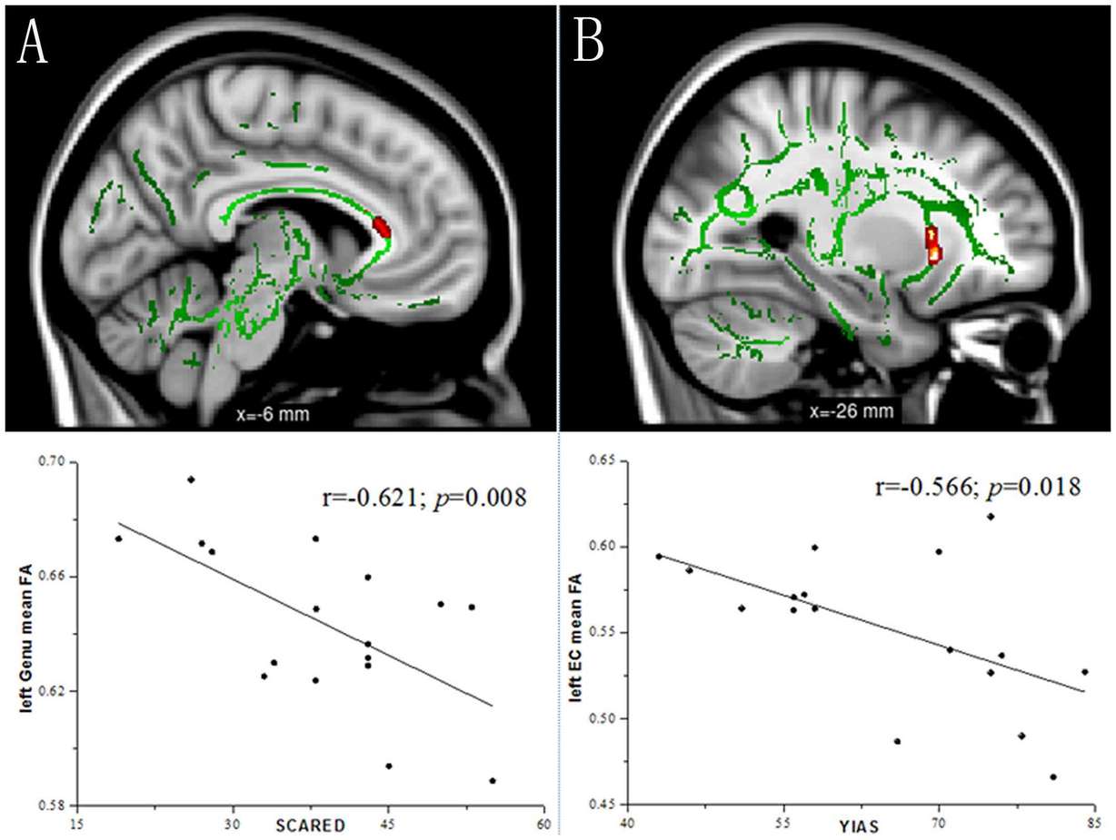 Internet addiction changes teen brain like drugs, study shows