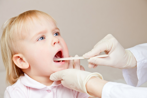 Mommy Medicine: Tonsils — to remove or not to remove?