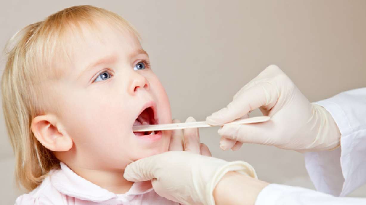 Mommy Medicine: Tonsils — to remove or not to remove?
