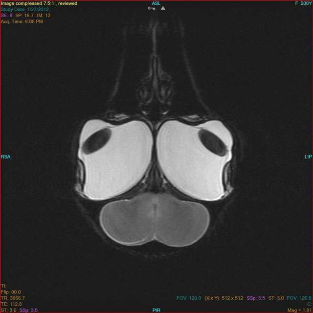 An MRI revealed no permanent damage to the bird's brain or optic nerve. (Photo courtesy Riverwoods Imaging Center)