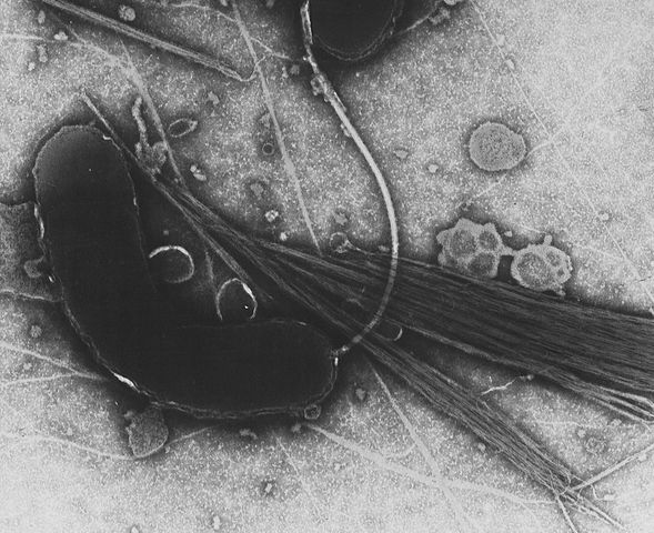 Natural bacteria help clean BP oil spill