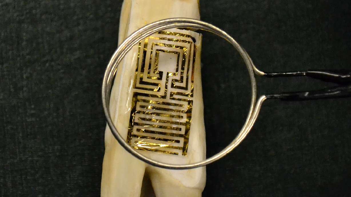 Tattoos on teeth could detect illness early