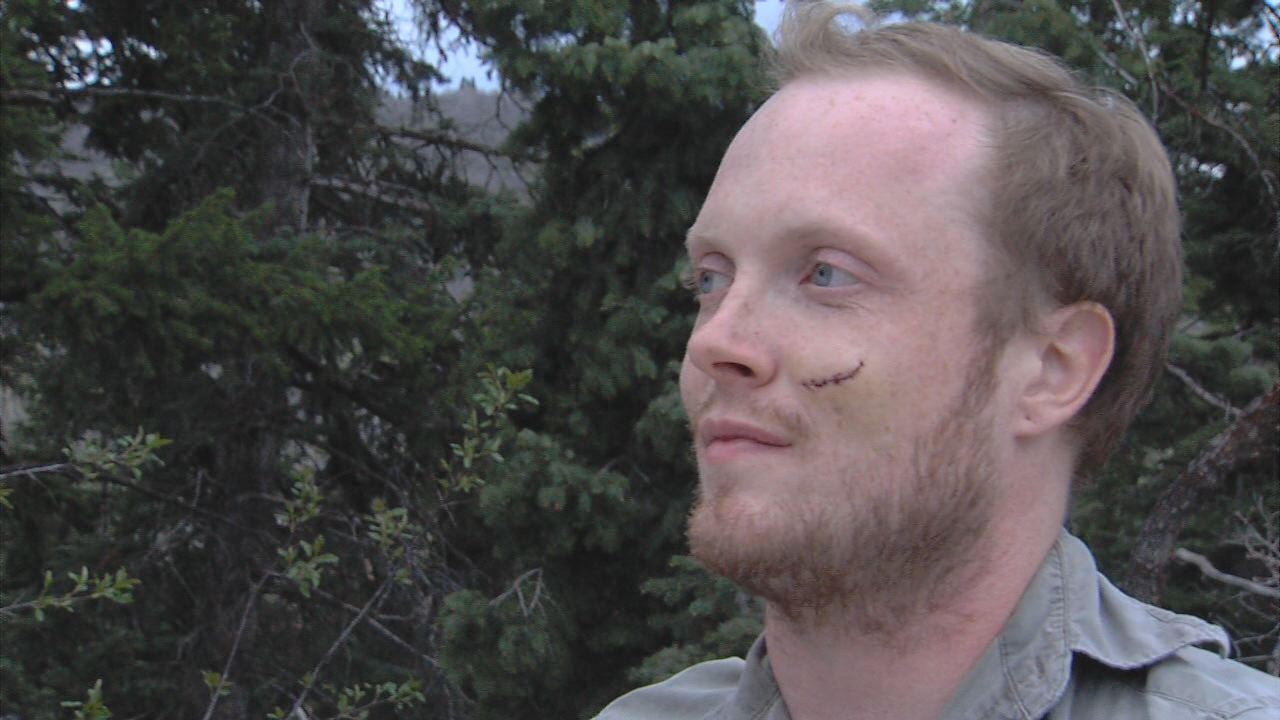 Victim of Smith's stabbing talks about experience