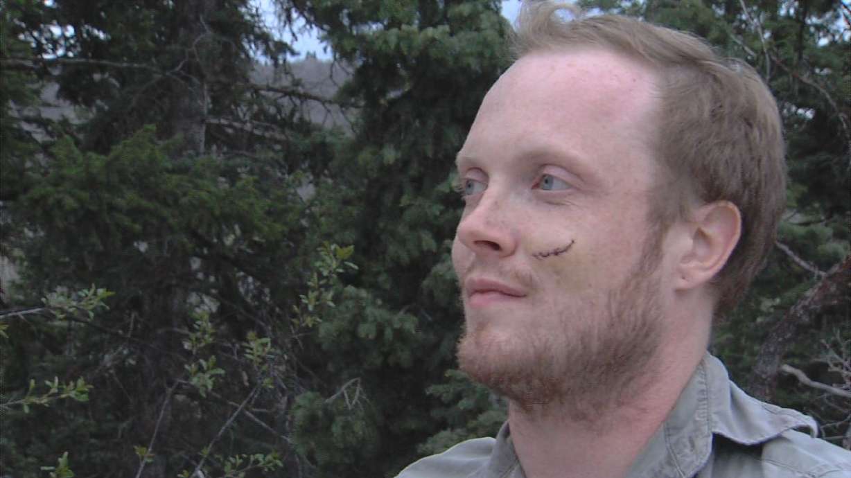 Victim of Smith's stabbing talks about experience