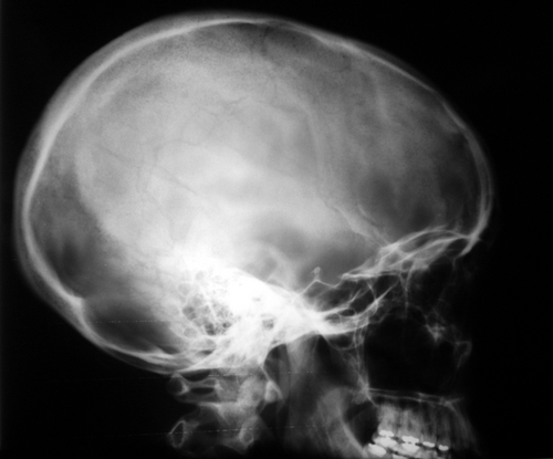 American heads are growing, study says