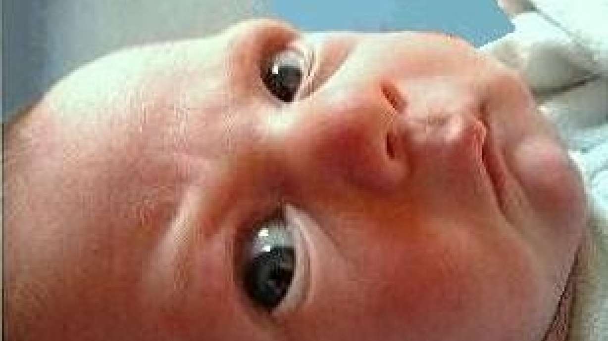 Circumcision — whose decision is it?