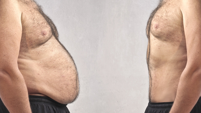 Being Obese Is Better Than Being Underweight [Science]