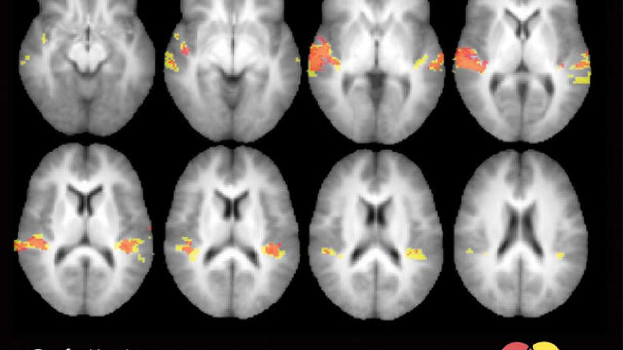 People who are deaf may develop keen sense of touch, study shows