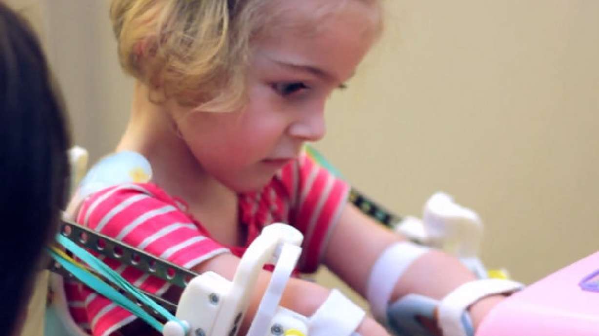 Disabled toddler moves freely using plastic exoskeleton
