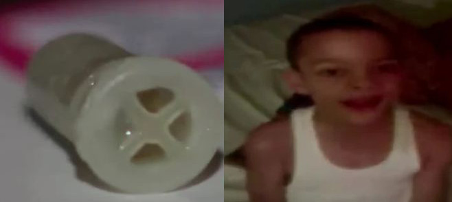 boy swallowed dog toy