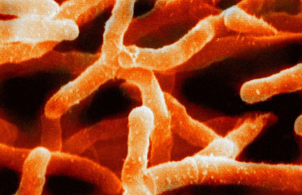 Actinobacteria, another component of the smell of rain.